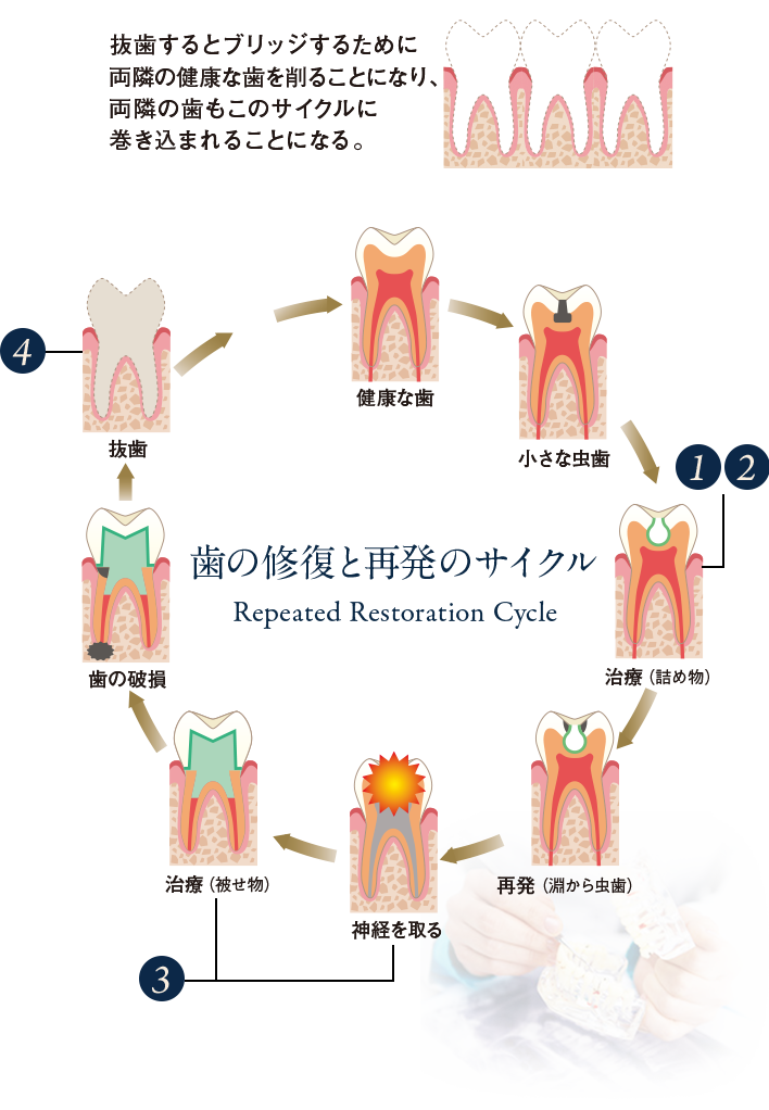 Repeated Restoration Cycle